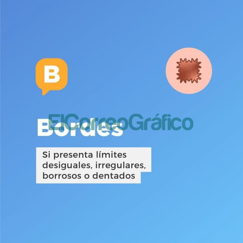 Recomendaciones para prevenir el cancer de piel 1
