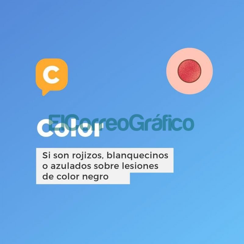 Recomendaciones para prevenir el cancer de piel 2
