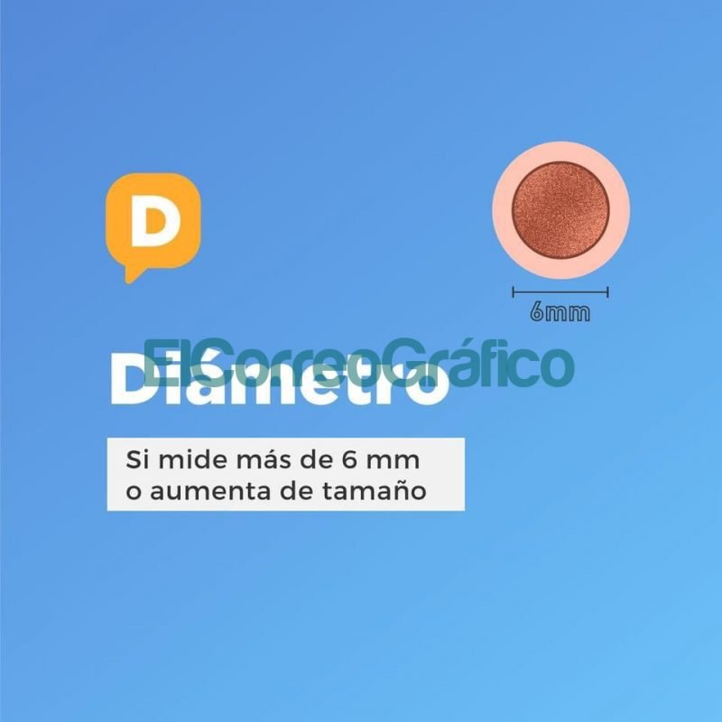 Recomendaciones para prevenir el cancer de piel 3