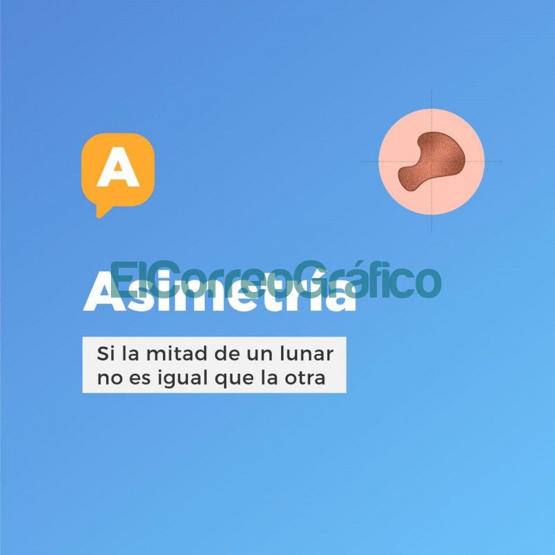 Recomendaciones para prevenir el cancer de piel 5
