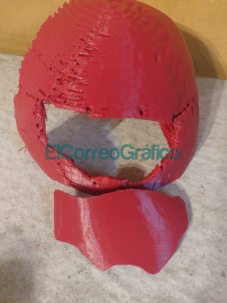 La UTN La Plata creo una protesis craneana para un paciente con fractura y desprendimiento oseo 2