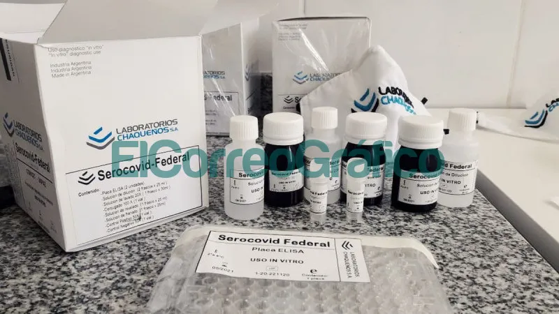 Los primeros kit nacionales para detectar anticuerpos estarán listos esta semana kits para detectar anticuerpos de SARS CoV 2