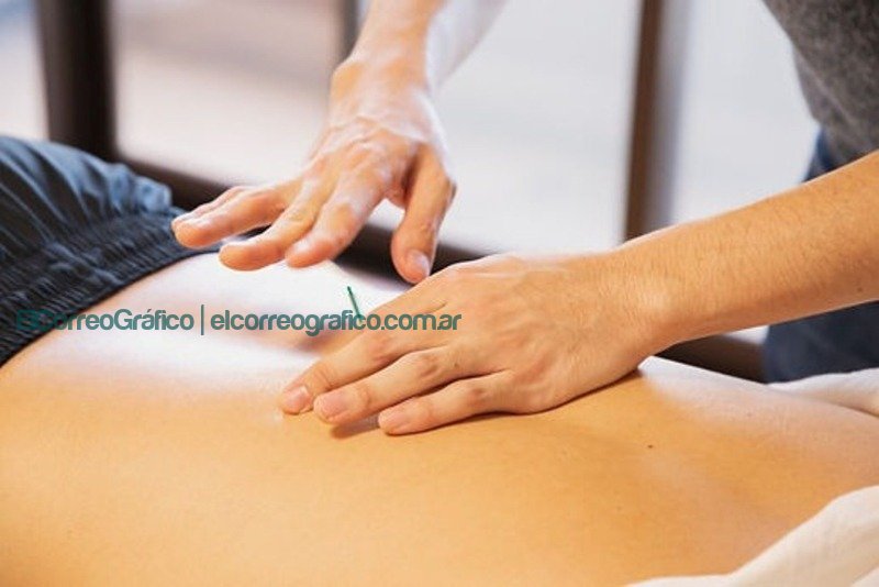 La antigua técnica usada por kinesiólogos se vuelve popular en tratamientos acupuntura 3